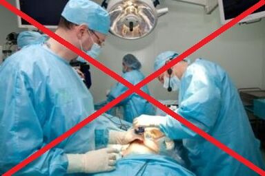 Augmentez un membre sans chirurgie